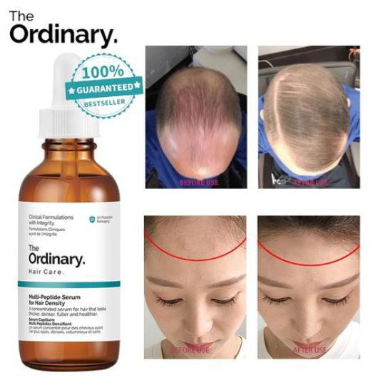 The Ordinary Hair Serum For Growth